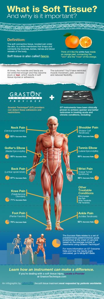 Graston 20InfoGraphic