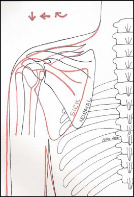 SICK 20Scap 20Drawing