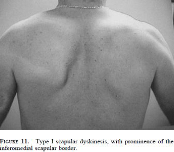 SICK 20Scapula 20Patient3